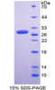 Rat Recombinant Superoxide Dismutase, Copper Chaperone (SOD4)