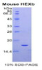 Mouse Recombinant Hexosaminidase B Beta (HEXb)