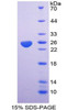 Mouse Recombinant Hyaluronan Binding Protein 1 (HABP1)