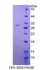 Rat Recombinant Glutathione S Transferase Alpha 4 (GSTa4)