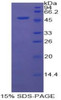 Cattle Recombinant Coagulation Factor V (F5)