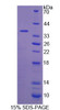 Cattle Recombinant Coagulation Factor V (F5)