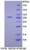 Human Recombinant Coagulation Factor XII (F12)