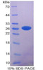 Mouse Recombinant Membrane Protein, Palmitoylated 2 (MPP2)