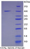 Rat Recombinant Mucin 5 Subtype B (MUC5B)