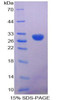 Human Recombinant Calretinin (CR)