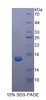 Human Recombinant Procalcitonin (PCT)