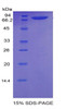 Rat Recombinant Neuropilin 1 (NRP1)