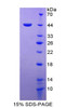 Human Recombinant Macrophage Migration Inhibitory Factor (MIF)