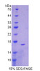 Mouse Recombinant Glucose 6 Phosphate Dehydrogenase (G6PD)