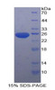 Rat Recombinant Stromal Cell Derived Factor 4 (SDF4)