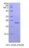 Mouse Recombinant Prostaglandin Endoperoxide Synthase 1 (PTGS1)