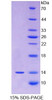 Human Recombinant Fibroblast Growth Factor 23 (FGF23)