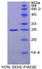 Rat Recombinant Complement Receptor 2 (CR2)