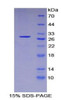 Human Recombinant Forkhead Box Protein O1 (FOXO1)