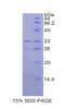 Human Recombinant Carbonic Anhydrase II (CA2)