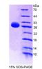 Mouse Recombinant Programmed Cell Death Protein 1 Ligand 1 (PDCD1LG1)