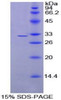 Rat Recombinant Programmed Cell Death Protein 1 Ligand 2 (PDCD1LG2)