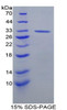 Rat Recombinant Topoisomerase II (TOP2)