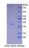 Human Recombinant Cyclin Dependent Kinase Inhibitor 2A (CDKN2A)