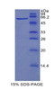 Cattle Recombinant Hypoxia Inducible Factor 1 Alpha (HIF1a)