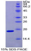 Chicken Recombinant Hypoxia Inducible Factor 1 Alpha (HIF1a)