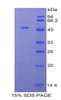 Cattle Recombinant Alpha-1-Acid Glycoprotein (a1AGP)
