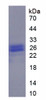 Pig Recombinant Alpha-1-Acid Glycoprotein (a1AGP)