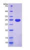 Rabbit Recombinant Alpha-1-Acid Glycoprotein (a1AGP)