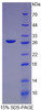 Rat Recombinant C Reactive Protein (CRP)