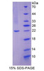 Human Recombinant Nitric Oxide Synthase 2, Inducible (NOS2)