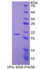 Rat Recombinant Nitric Oxide Synthase 2, Inducible (NOS2)