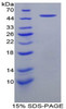 Rabbit Recombinant Coagulation Factor IX (F9)