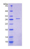 Rat Recombinant Prolactin (PRL)