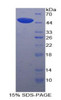 Dog Recombinant Phospholipase A2, Lipoprotein Associated (LpPLA2)