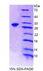 Chicken Recombinant Complement Component 4 (C4)