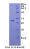 Rabbit Recombinant Acid Phosphatase 5, Tartrate Resistant (ACP5)