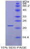 Chicken Recombinant Retinol Binding Protein 4, Plasma (RBP4)