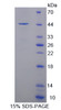 Human Recombinant Synuclein Gamma (SNCg)