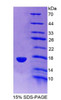 Rat Recombinant Synuclein Gamma (SNCg)