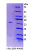 Human Recombinant Immunoglobulin Lambda Like Polypeptide 1 (IglL1)