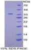 Mouse Recombinant Neutrophil Specific Antigen 1 (NB1)