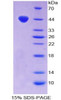 Mouse Recombinant Chemerin (CHEM)