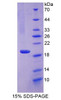 Mouse Recombinant Chemerin (CHEM)