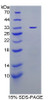 Mouse Recombinant Thymidine Phosphorylase (TP)