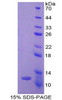 Human Recombinant Ghrelin (GHRL)