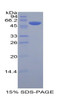 Human Recombinant Killer Cell Immunoglobulin Like Receptor 3DL2 (KIR3DL2)