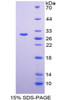 Mouse Recombinant Alpha-1-Antichymotrypsin (a1ACT)