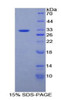 Human Recombinant Protein Tyrosine Phosphatase Receptor Type B (PTPRB)