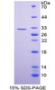 Human Recombinant Dopachrome Tautomerase (DCT)